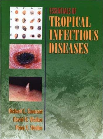 Doenças Infecciosas Tropicais